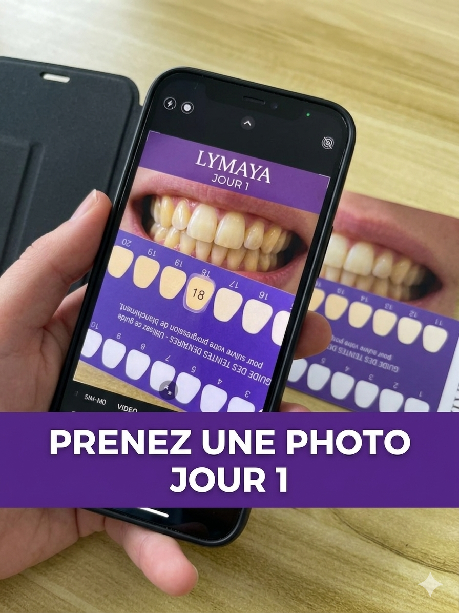 Bandes de Blanchiment Dentaire LYMAYA
